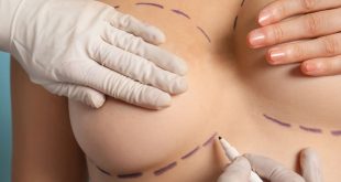 Breast Fat Transfer in Dubai