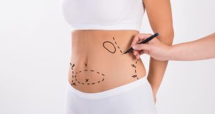 Everything You Need to Know About Liposuction in Dubai