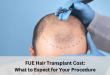 fue hair transplant