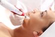 Microneedling near me