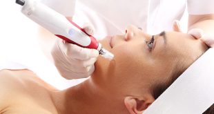 Microneedling near me