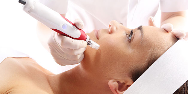 Microneedling near me