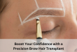 brow hair transplant